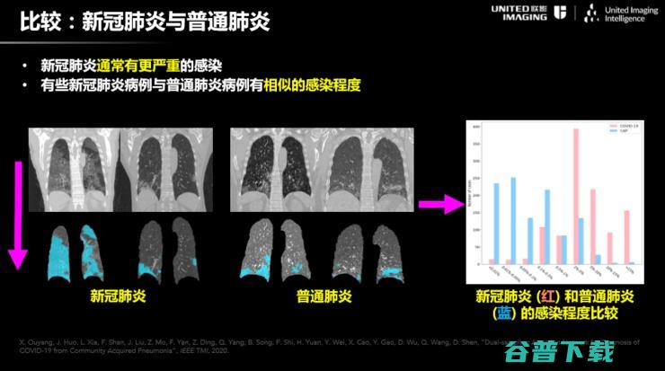 联影智能联席CEO沈定刚：如何将AI应用到新冠肺炎诊断全流程？ | CCF-GAIR 