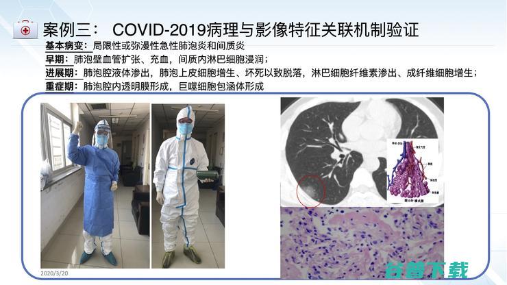 佑安医院放射科主任李宏军：我为什么力挺AI与影像基因组学的结合前景？｜CMAI 2022