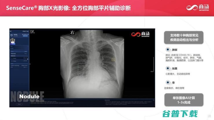 商汤科技副总裁张少霆：AI 赋能临床医疗的心得 | CCF-GAIR 2020