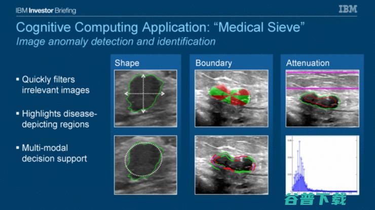 九个医疗健康领域，人工智能如何大显神通？