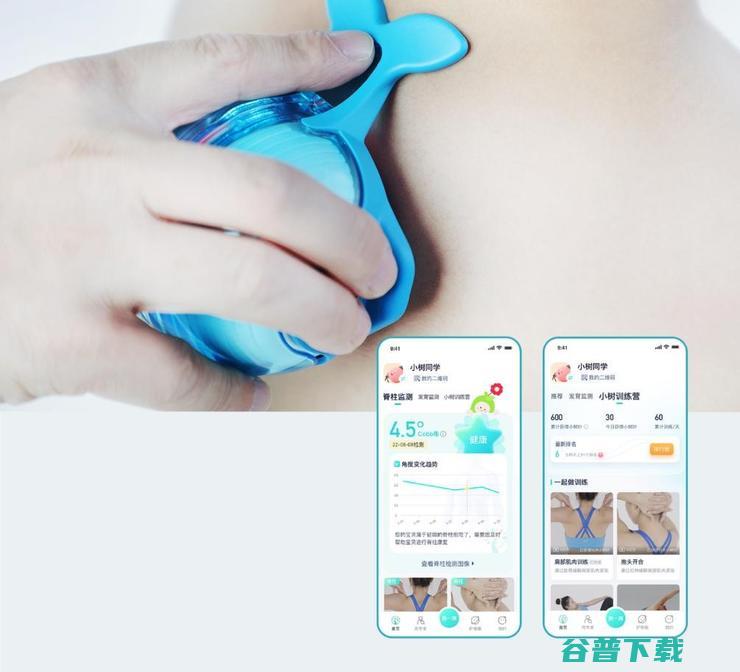 芙索特完成数千万Pre-A轮融资，助力全球儿童青少年脊柱健康筛查与诊疗