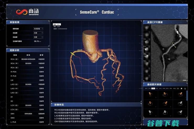 对话副总裁张少霆：新基建下，医疗AI有哪些新故事?